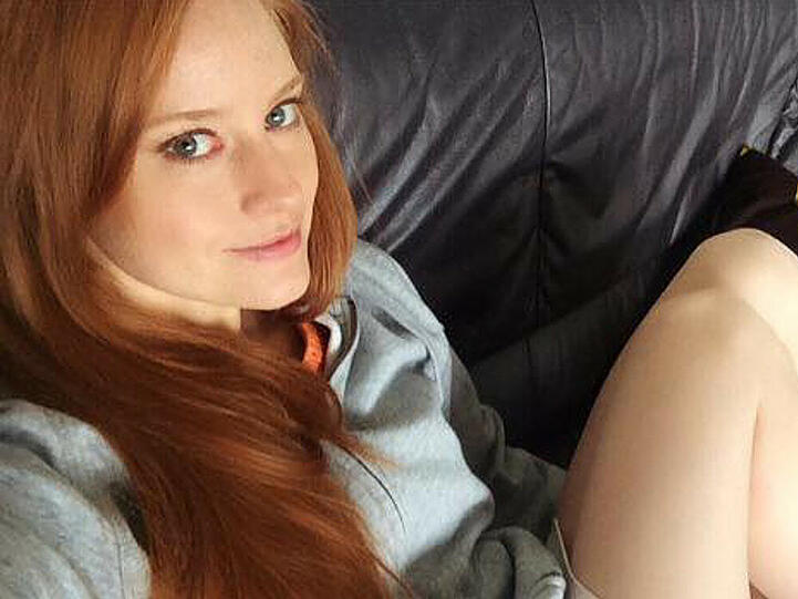 Barbara Meier (28) gewann mit ihren roten Haaren 2007 bei "Germany's next Topmodel". Sie findet es aber schade, dass Rothaarige immer noch oft gehänselt werden.