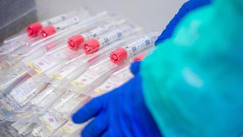 Innerhalb von 24 Stunden ist ein neuer Rekord an Neuinfektionen registriert worden.