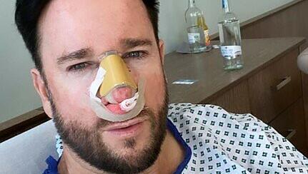 Michael Wendler grüßt seine Fans nach einer Nasen-OP aus dem Krankenbett. Michael Wendler grüßt seine Fans nach einer Nasen-OP aus dem Krankenbett.