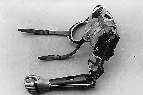 Ebenfalls aus der Schmiede von MAN: Eine Armprothese, wie sie vor dem Zweiten Weltkrieg produziert wurde.