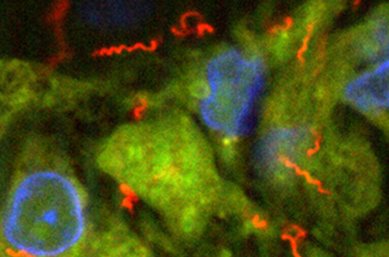Treponema pallidum, der Erreger der Syphilis - die Geschlechtskrankheiten Syphilis, Gonorrhoe und Chlamydiose sind wegen Antibiotikaresistenzen immer schwerer zu bekämpfen. Foto: PD Dr. Annette Moter/Charite-Universitätsmedizin Berlin
