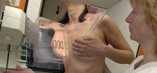 Frauen sollten nicht nur monatlich ihre Brust abtasten, sondern auch regelmäßig zur Mammographie gehen.