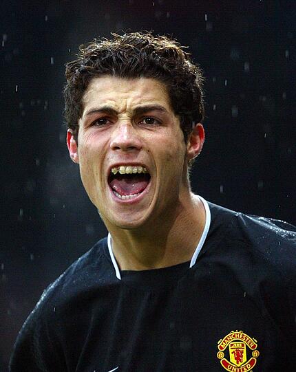 Cristino Ronaldo achtet sehr auf sein Aussehen, deshalb trug er lange eine Zahnspange