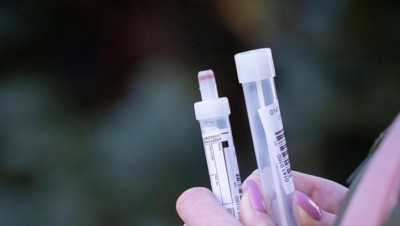 Eine Patientin in Berlin mit zwei Teströhrchen in der Hand für einen Abstrichtest und eine Blutprobe. Eine Patientin in Berlin mit zwei Teströhrchen in der Hand für einen Abstrichtest und eine Blutprobe.