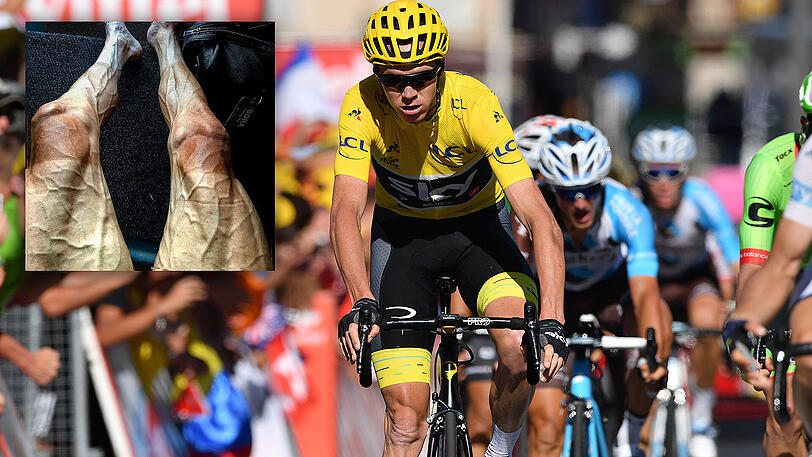 Wie kräftezehrend die Tour de France sein kann, zeigen die Beine von Pawel Poljanski.