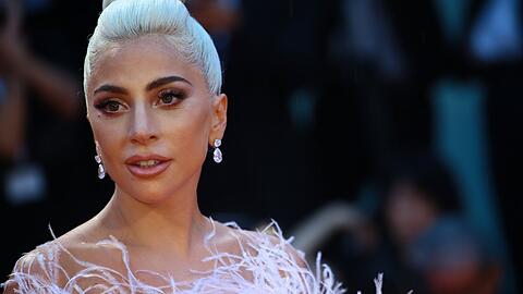 Lady Gaga hat inzwischen all ihre Hunde wieder.