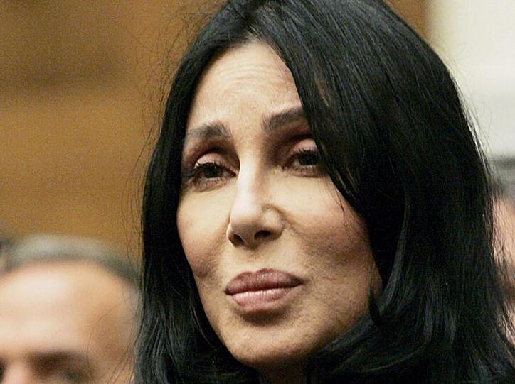 Cher ist offen für plastische Chirurgie
