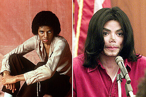 Michael Jackson: 1979 in jungen Jahren und 2002 frisch operiert vor Gericht.