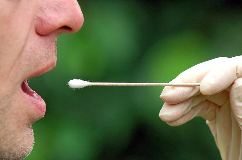 Kurz und schmerzlos: Mit einem Wattestäbchen wird eine Speichelprobe entnommen, amtlich heißt dies Mumdhöhlenabstrich. Aus dem Material wird ein individuelles DNA-Muster der Testperson erstellt.