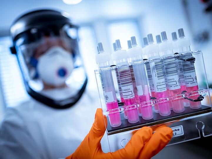 Eine wissenschaftliche Mitarbeiterin hält Coronavirus-Testproben in der Hand. Foto: Peter Steffen/dpa/Archivbild