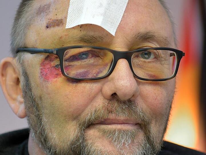 Frank Magnitz, Landesvorsitzender der AfD Bremen, nach seiner Entlassung aus dem Krankenhaus.