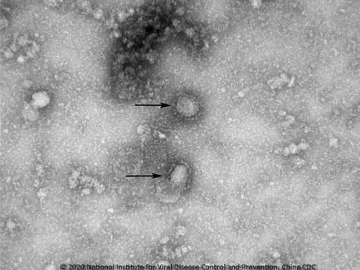 Eine Mikroskopaufnahme zeigt den neuen Stamm des Coronavirus. Foto: IVDC/China CDC via GISAID/dpa/Archivbild
