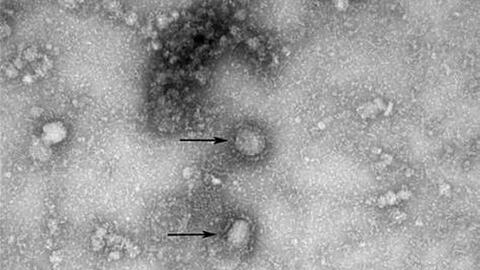 Eine Mikroskopaufnahme zeigt den neuen Stamm des Coronavirus. Foto: IVDC/China CDC via GISAID/dpa/Archivbild