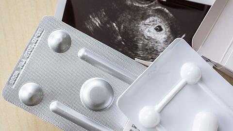 Zum ersten Mal wurde bei Schwangerschaftsabbr&uuml;chen das Medikament Mifegyne h&auml;ufiger genutzt als die Absaugmethode. (Archivbild)