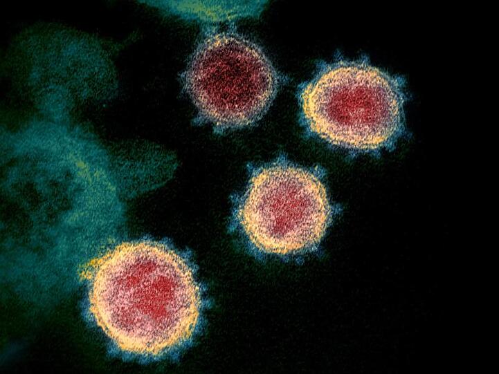 Eine elektronenmikroskopische Aufnahme zeigt das neuartige Coronavirus (SARS-CoV-2), das Covid-19 verursacht.