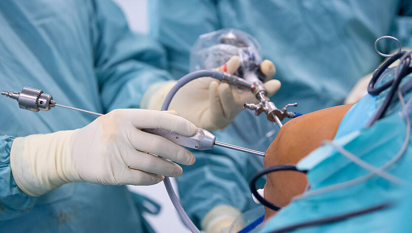 Ein Arzt operiert einen Patienten am Knie. Trotz eines hohen medizinischen Niveaus in Deutschland können in solchen Fällen Fehler passieren.