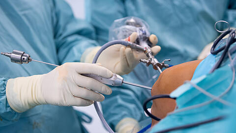 Ein Arzt operiert einen Patienten am Knie. Trotz eines hohen medizinischen Niveaus in Deutschland können in solchen Fällen Fehler passieren.