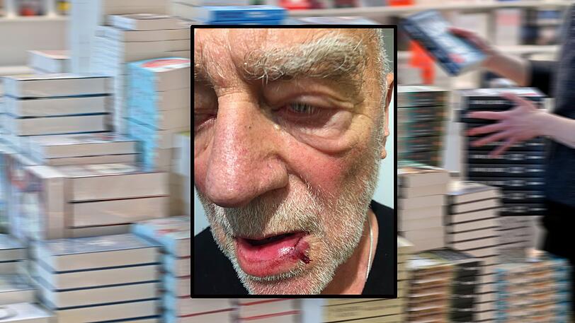 Joachim Bergmann auf der Frankfurter Buchmesse - kurz nachdem er dort ins Gesicht geschlagen worden ist.