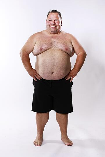 Dirk (38) aus Bad Krozingen; Startgewicht: 145,4 Kilo