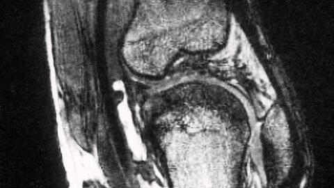 Schmerzen im Knie treiben viele Versicherte zum Orthopäden - viele kommen dort mit fragwürdigen Therapien in Kontakt. (Archivbild)