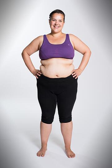 Vorher vs. nachher: Erzieherin Alexandra hat 103,4 Kilo gewogen. Jetzt wiegt sie 50,2 Kilo.