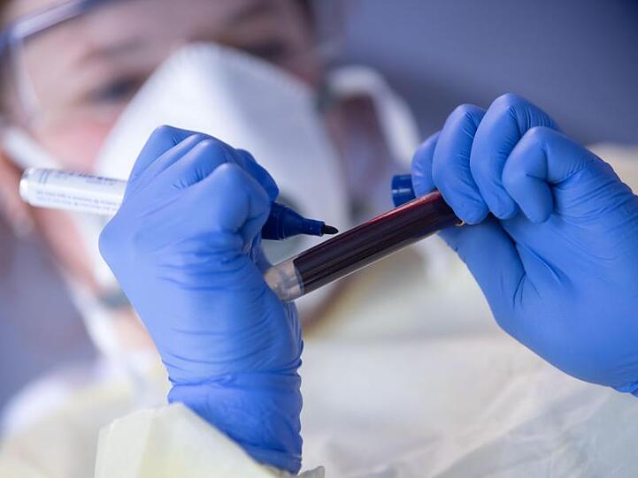 Ein Mitarbeiterin des Robert Koch-Instituts (RKI) beschriftet zum Start der Studie "Corona-Monitoring lokal" eine Blutprobe für einen Antikörpertest.