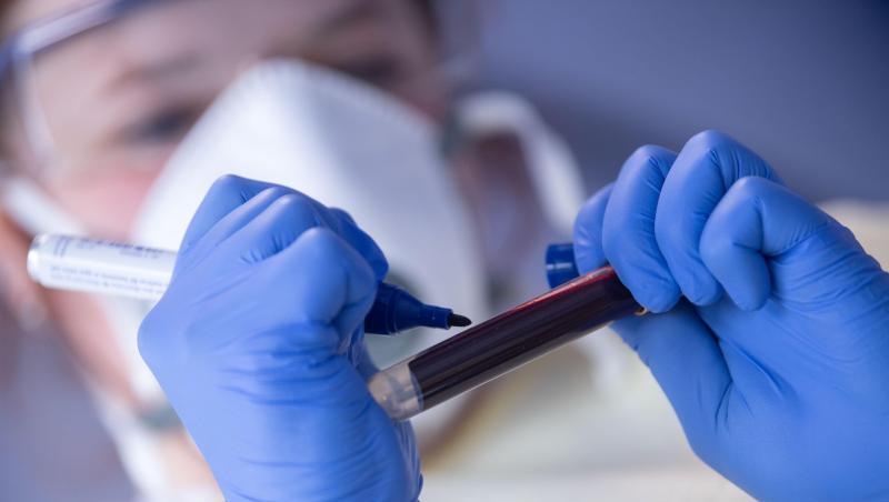 Ein Mitarbeiterin des Robert Koch-Instituts (RKI) beschriftet zum Start der Studie "Corona-Monitoring lokal" eine Blutprobe für einen Antikörpertest. Ein Mitarbeiterin des Robert Koch-Instituts (RKI) beschriftet zum Start der Studie "Corona-Monitoring lokal" eine Blutprobe für einen Antikörpertest.