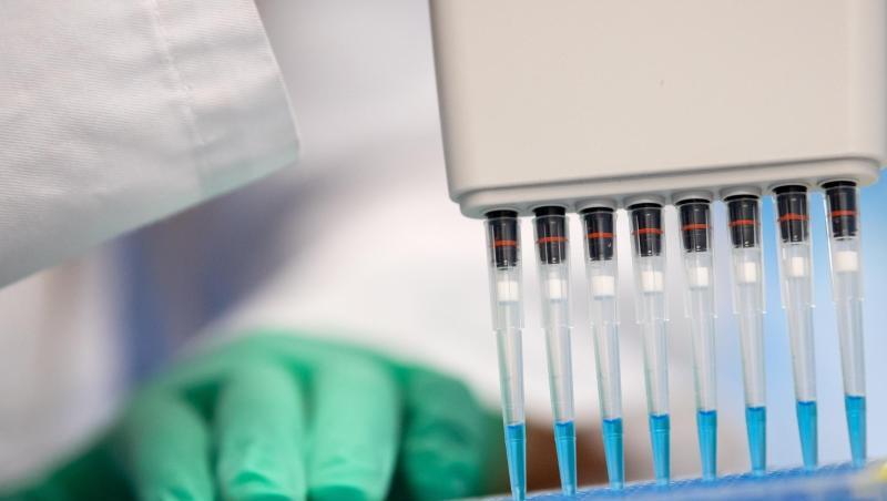 Eine Mitarbeiterin pipettiert in einem Labor einen Ansatz zum Proteinnachweis. Foto: Sven Hoppe/dpa/Archivbild Eine Mitarbeiterin pipettiert in einem Labor einen Ansatz zum Proteinnachweis. Foto: Sven Hoppe/dpa/Archivbild