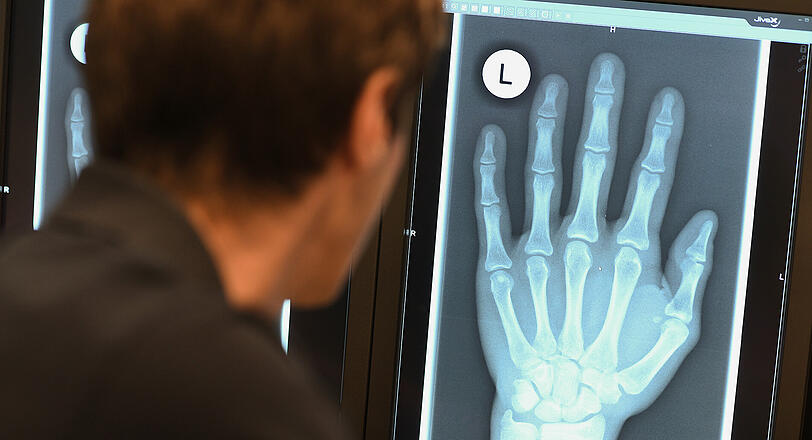 Ein Radiologe schaut sich im Röntgenbild die linke Hand eines 17-Jährigen an.