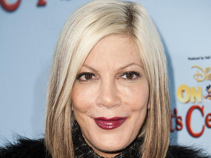 Tori Spelling erholt sich von einer Hauttransplantation