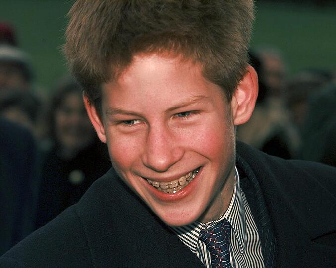 Lang, lang ist's her: Der noch junge Prinz Harry mit Zahnspange in seiner Teenie-Zeit.