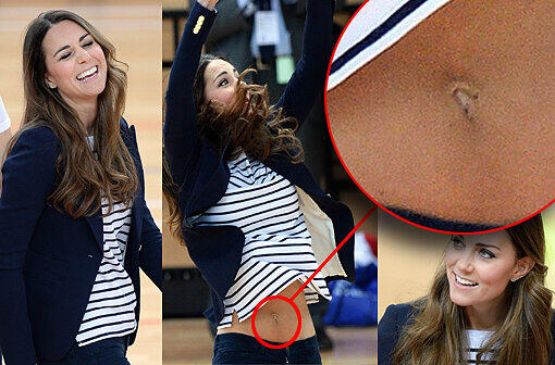 Hoppla! Da geht doch glatt das Oberteil hoch! Prinz Williams Kate spielt Volleball, plötzlich hüpft das gestreifte Shirt nach oben. Zu sehen: Nicht nur Kates superflacher Bauch, sondern auch die Einstichlöchlein eines Bauchnabel-Piercings! Die Bilder.