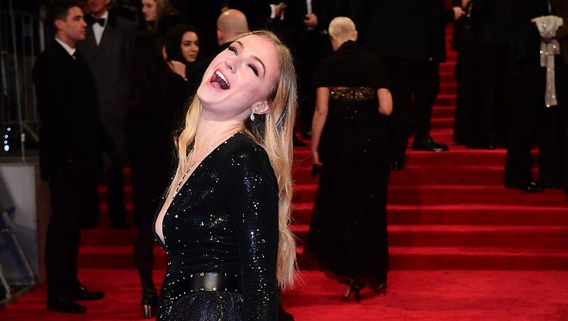 Schauspielerin Sophie Turner erschien mit sichtbar blauen Flecken am Bein Schauspielerin Sophie Turner erschien mit sichtbar blauen Flecken am Bein