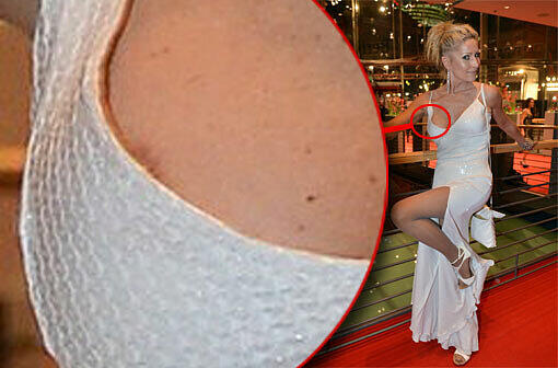 Hoppala! Aber trotzdem ein echter Hingucker! Eine Kleiderpanne bei Birgit Stein auf der Berlinale