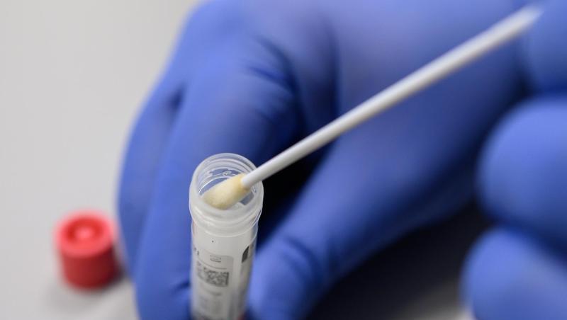 Ein Mann zeigt einen Abstrich für das Testverfahren auf das Virus SARS-CoV-2. Foto: Sebastian Gollnow/dpa/Symbolbild Ein Mann zeigt einen Abstrich für das Testverfahren auf das Virus SARS-CoV-2. Foto: Sebastian Gollnow/dpa/Symbolbild