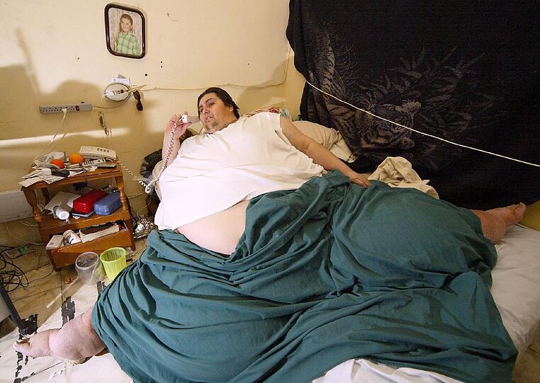 Manuel Uribe hatte in den letzten Jahren über 200 Kilo abgespeckt. Am Montag kam der fettleibige Mexikaner mit Herzproblemen ins Krankenhaus, wo der schließlich verstarb.