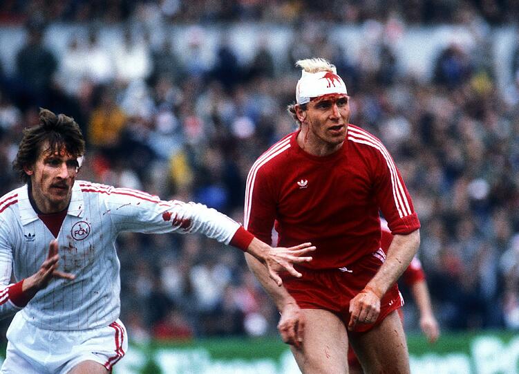 Doch Hoeneß biss auf die Zähne und spielte - heute undenkbar - mit einem provisorischen Turban-Verband weiter. Zur Halbzeit führten die Clubberer im Frankfurter Waldstadion mit 2:0, doch der FC BAyern kam nochmal zurück.