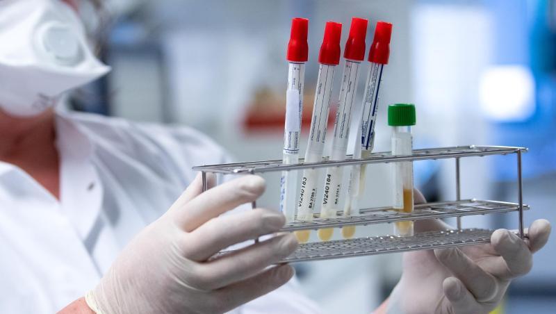 Eine Mitarbeiterin bereitet Proben von Menschen mit Covid-19 Verdacht für die weitere Analyse vor. Foto: Sven Hoppe/dpa/Symbolbild Eine Mitarbeiterin bereitet Proben von Menschen mit Covid-19 Verdacht für die weitere Analyse vor. Foto: Sven Hoppe/dpa/Symbolbild