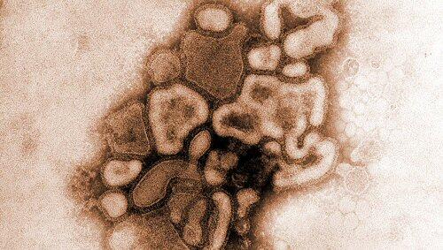 Schweinegrippe-Virus reist um die Welt Schweinegrippe-Virus reist um die Welt