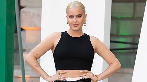 Anne-Marie lässt in ihrem neuen Album "Unhealthy" tiefe Einblicke in ihre gescheiterten Beziehungen zu.