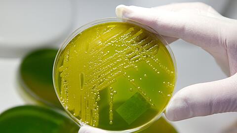 Ehec steht für enterohämorrhagische Escherichia coli und bezeichnet bestimmte krankmachende Stämme des Darm-Bakteriums, die vor allem bei Wiederkäuern wie Rindern vorkommen. (Archivbild)