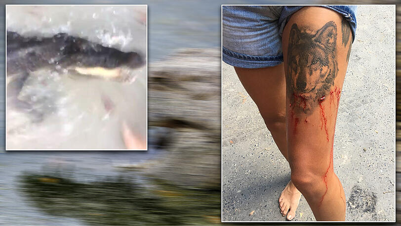 Links das Krokodil beim Angriff. Rechts die Bisswunden am Bein.