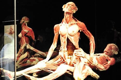 Umstritten: Der Leichen-Akt in der Ausstellung "Körperwelten".