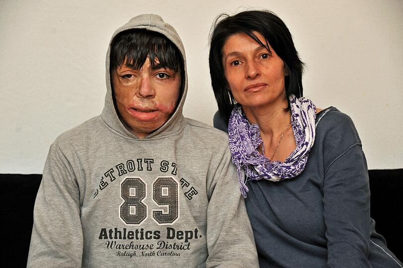 Gavril und seine Tante Dragica Kazandziska: Sie kämpfen weiter, bis genug Geld für Operationen beisammen ist.
