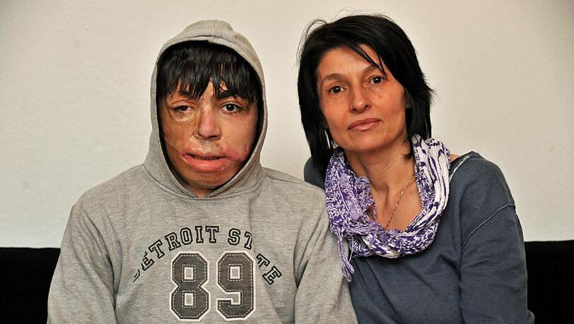 Gavril und seine Tante Dragica Kazandziska: Sie kämpfen weiter, bis genug Geld für Operationen beisammen ist. Gavril und seine Tante Dragica Kazandziska: Sie kämpfen weiter, bis genug Geld für Operationen beisammen ist.