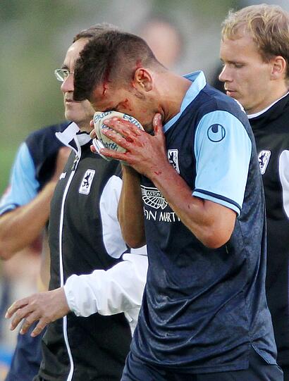 Beim 0:0 im Test gegen Austria muss Guillermo Vallori mit viel Blut am Kopf vom Feld. Die Löwen-Fans befürchten schnell schlimmstes &ndash; Trainer Maurer aber bleibt gelassen. Sehen Sie hier die Bilder.