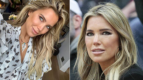 Das Gesicht von Sylvie Meis sieht im Vergleich zu früher ganz anders aus.