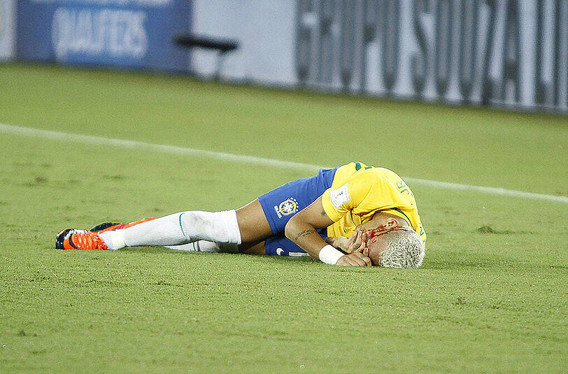 Die Neymar-Show beim 5:0 (4:0) im WM-Qualifikationsspiel gegen Bolivien fand nach einem Ellbogen-Stoß ihr spektakuläres, blutiges Schlussbild.