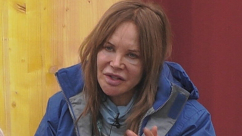 Doreen Dietel spricht Klartext über ihre Lippen-Korrektur.