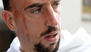 Muss sich schonen: Franck Ribéry